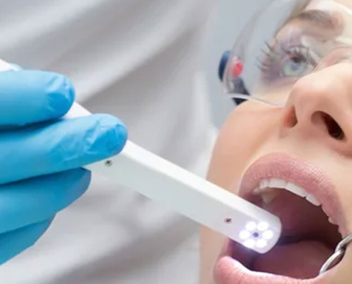 Intraoral Camera